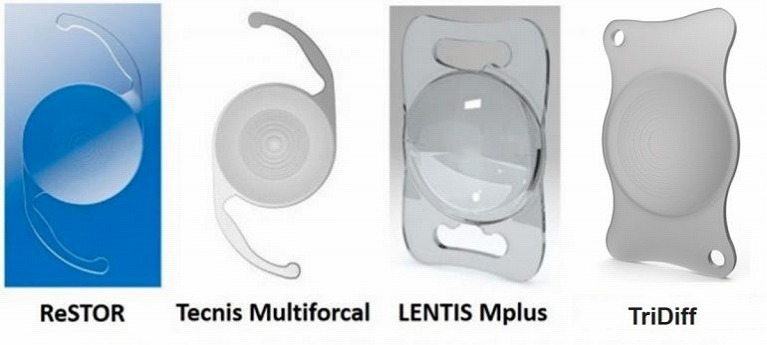 当院で選択可能な多焦点眼内レンズ
