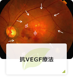 抗VEGF療法