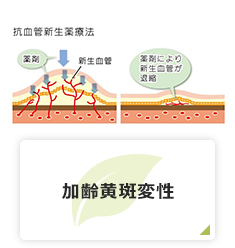 加齢黄斑変性