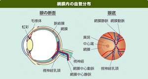 網膜静脈閉塞症とは